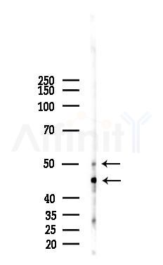 MCSF Receptor Antibody - Western blot analysis of lysates from 293 cells(UV 30min treatment), using MCSF Receptor Antibody at 1/1000 dilution.