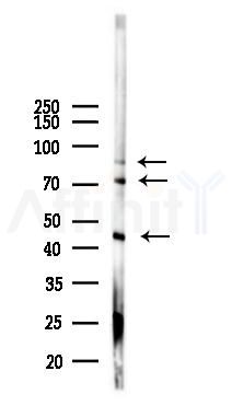 MCSF Receptor Antibody - Western blot analysis of lysates from 293 cells(UV 30min treatment), using MCSF Receptor Antibody at 1/1000 dilution.