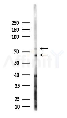 MCSF Receptor Antibody - Western blot analysis of lysates from Hela cells(starvation 24h treatment), using MCSF Receptor Antibody at 1/1000 dilution.