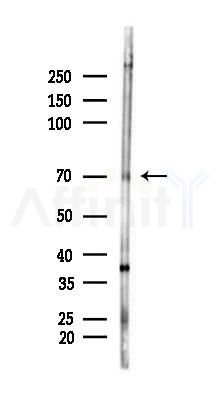 MCSF Receptor Antibody - Western blot analysis of lysates from Rat brain, using MCSF Receptor Antibody at 1/1000 dilution.