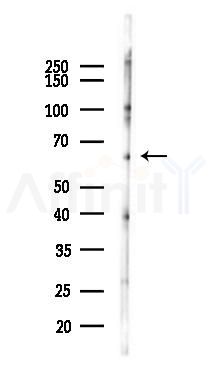 MCSF Receptor Antibody - Western blot analysis of lysates from Mouse lung, using MCSF Receptor Antibody at 1/1000 dilution.