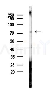 MCSF Receptor Antibody - Western blot analysis of lysates from B16F10-LUC cells(starvation 24h treatment), using MCSF Receptor Antibody at 1/1000 dilution.
