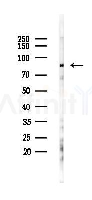 MCSF Receptor Antibody - Western blot analysis of lysates from B16F10-LUC cells(starvation 24h treatment), using MCSF Receptor Antibody at 1/1000 dilution.