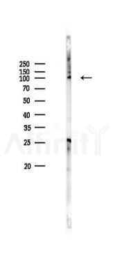 IGF1 Receptor Antibody - Western blot analysis of lysates from K562 cells(heat-shock 45min treatment), using IGF1 Receptor Antibody at 1/1000 dilution.