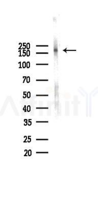 PDGF Receptor beta Antibody - Western blot analysis of lysates from Mouse lung, using PDGF Receptor beta Antibody at 1/1000 dilution.