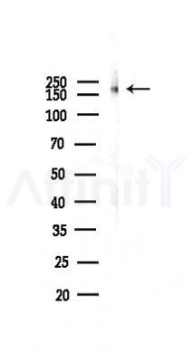 PDGF Receptor beta Antibody - Western blot analysis of lysates from PC12 cells(LPS 4h treatment), using PDGF Receptor beta Antibody at 1/1000 dilution.