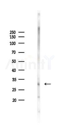 Bcl-2 Antibody - Western blot analysis of lysates from Mouse lung, using Bcl-2 Antibody at 1/1000 dilution.