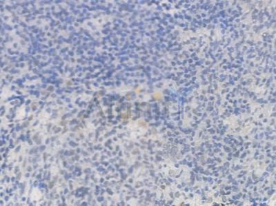 NUR77 Antibody - AF4712 at 1/100 staining human normal tonsil tissue by IHC-P.