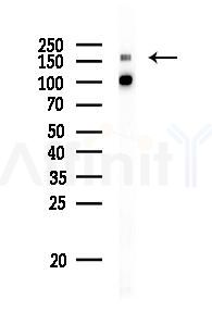 IRS1 Antibody - Western blot analysis of lysates from K562 cells(starvation 24h treatment), using IRS1 Antibody at 1/1000 dilution.