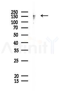 IRS1 Antibody - Western blot analysis of lysates from K562 cells(starvation 24h treatment), using IRS1 Antibody at 1/1000 dilution.