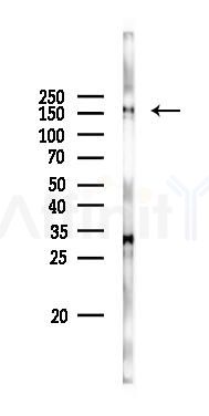 IRS1 Antibody - Western blot analysis of lysates from PC12 cells(LPS 4h treatment), using IRS1 Antibody at 1/1000 dilution.