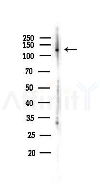 SREBP1 Antibody - Western blot analysis of lysates from PC12 cells(LPS 4h treatment), using SREBP1 Antibody at 1/1000 dilution.