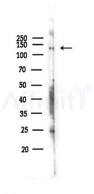 SREBP1 Antibody - Western blot analysis of lysates from Hela cells(LPS 4h treatment), using SREBP1 Antibody at 1/1000 dilution.