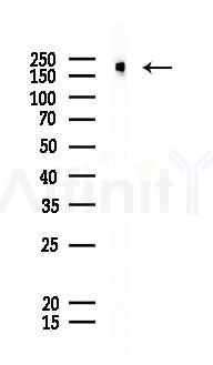 Tuberin/TSC2 Antibody - Western blot analysis of lysates from K562 cells(starvation 24h treatment), using Tuberin/TSC2 Antibody at 1/1000 dilution.