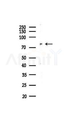 IRAK1 Antibody - Western blot analysis of lysates from K562 cells(UV 30min treatment), using IRAK1 Antibody at 1/1000 dilution.