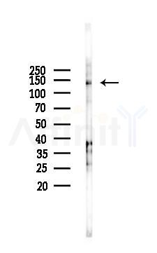 p130 Cas Antibody - Western blot analysis of lysates from HUVEC cells(starvation 24h treatment), using p130 Cas Antibody at 1/1000 dilution.