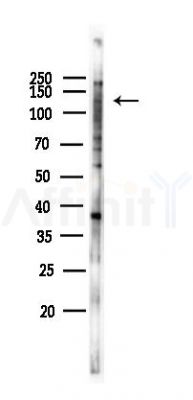 FOXM1 Antibody - Western blot analysis of lysates from Hela cells(LPS 4h treatment), using FOXM1 Antibody at 1/1000 dilution.