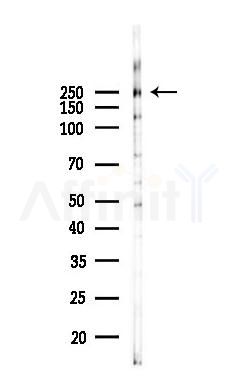 ATR Antibody - Western blot analysis of lysates from K562 cells(UV 30min treatment), using ATR Antibody at 1/1000 dilution.