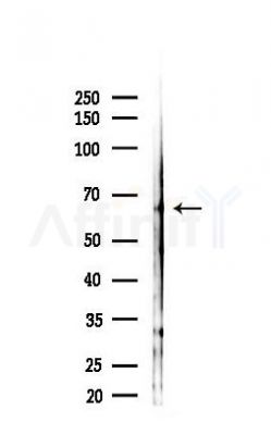 RUNX2 Antibody - Western blot analysis of lysates from Hela cells(starvation 24h treatment), using RUNX2 Antibody at 1/1000 dilution.