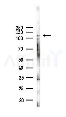 GEF H1 Antibody - Western blot analysis of lysates from K562 cells(UV 30min treatment), using GEF H1 Antibody at 1/1000 dilution.