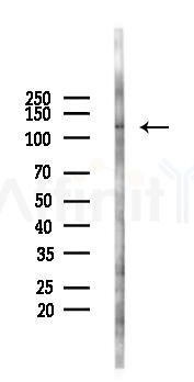 SirT1 Antibody - Western blot analysis of lysates from 293 cells(LPS 4h treatment), using SirT1 Antibody at 1/1000 dilution.