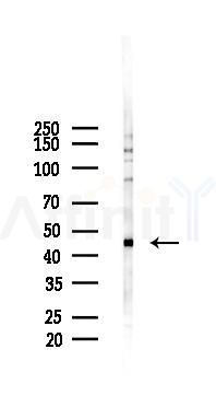 PAR4 Antibody - Western blot analysis of lysates from PC12 cells(LPS 4h treatment), using PAR4 Antibody at 1/1000 dilution.