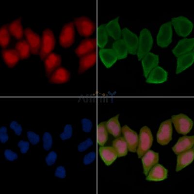 PAR4 Antibody - AF4785 staining Hela cells(45min of heat-shock treatment) by IF/ICC.
