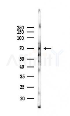CDCP1 Antibody - Western blot analysis of lysates from K562 cells(UV 30min treatment), using CDCP1 Antibody at 1/1000 dilution.