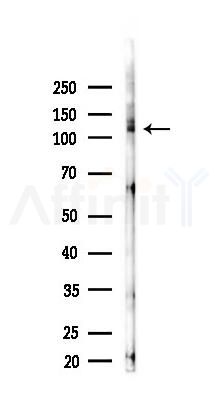 ALK Antibody - Western blot analysis of lysates from Hela cells(starvation 24h treatment), using ALK Antibody at 1/1000 dilution.
