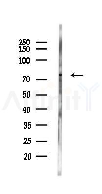Rabphilin 3A Antibody - Western blot analysis of lysates from Rat brain, using Rabphilin 3A Antibody at 1/1000 dilution.