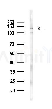 TACC3 Antibody - Western blot analysis of lysates from Rat brain, using TACC3 Antibody at 1/1000 dilution.
