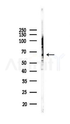 RIPK3 Antibody - Western blot analysis of lysates from K562 cells(UV 30min treatment), using RIP3/RIPK3 Antibody at 1/1000 dilution.
