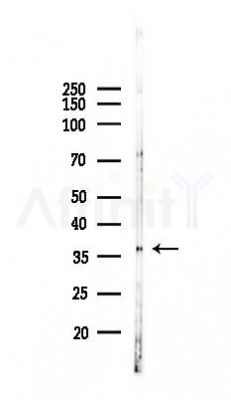 IKB alpha Antibody - Western blot analysis of lysates from K562 cells(UV 30min treatment), using IKB alpha Antibody at 1/1000 dilution.