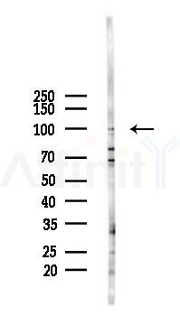 NR3C1 Antibody - Western blot analysis of lysates from PC12 cells(LPS 4h treatment), using NR3C1 Antibody at 1/1000 dilution.