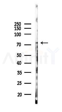 NF-kB p65 Antibody - Western blot analysis of lysates from K562 cells(UV 30min treatment), using NF-kB p65 Antibody at 1/1000 dilution.
