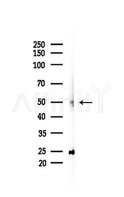 Chk1 Antibody - Western blot analysis of lysates from Rat liver, using Chk1 Antibody at 1/1000 dilution.
