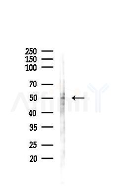 GSK3 beta Antibody - Western blot analysis of lysates from COLO205 cells(UV 30min treatment), using GSK3 beta Antibody at 1/1000 dilution.