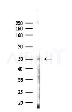 GSK3 beta Antibody - Western blot analysis of lysates from A2780 cells(LPS 4h treatment), using GSK3 beta Antibody at 1/1000 dilution.