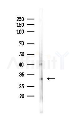 IL1 beta Antibody - Western blot analysis of lysates from Rat lung, using IL1 beta Antibody at 1/1000 dilution.