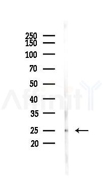 Connexin 26 Antibody - Western blot analysis of lysates from K562 cells(heat-shock 45min treatment), using Connexin 26 Antibody at 1/1000 dilution.