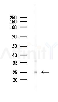 Connexin 26 Antibody - Western blot analysis of lysates from Mouse liver, using Connexin 26 Antibody at 1/1000 dilution.