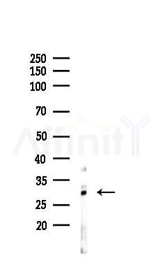 CD63 Antibody - Western blot analysis of lysates from Rat brain, using CD63 Antibody at 1/1000 dilution.