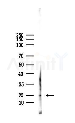CD63 Antibody - Western blot analysis of lysates from Mouse liver, using CD63 Antibody at 1/1000 dilution.