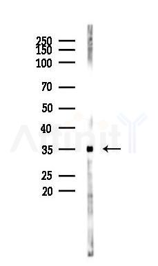CD63 Antibody - Western blot analysis of lysates from RAW264.