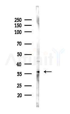 CD63 Antibody - Western blot analysis of lysates from 293 cells(heat-shock 45min treatment), using CD63 Antibody at 1/1000 dilution.