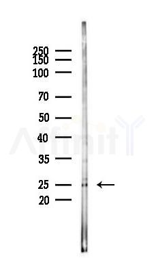 CD63 Antibody - Western blot analysis of lysates from Rat testis, using CD63 Antibody at 1/1000 dilution.