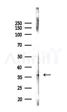 CD63 Antibody - Western blot analysis of lysates from A2780 cells(LPS 4h treatment), using CD63 Antibody at 1/1000 dilution.