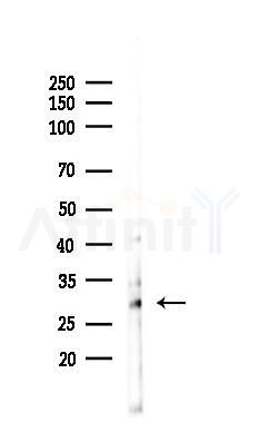 CD63 Antibody - Western blot analysis of lysates from Hela cells(starvation 24h treatment), using CD63 Antibody at 1/1000 dilution.