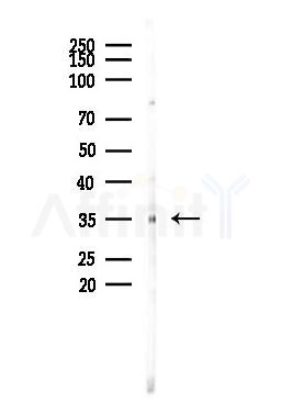 CD63 Antibody - Western blot analysis of lysates from RAW264.