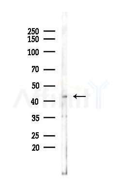CD63 Antibody - Western blot analysis of lysates from COLO205 cells(UV 30min treatment), using CD63 Antibody at 1/1000 dilution.